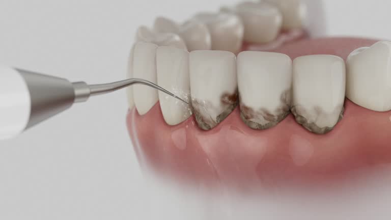 Reliable Dental Implants contractor in Garnet, CA by Smile Center Dentistry